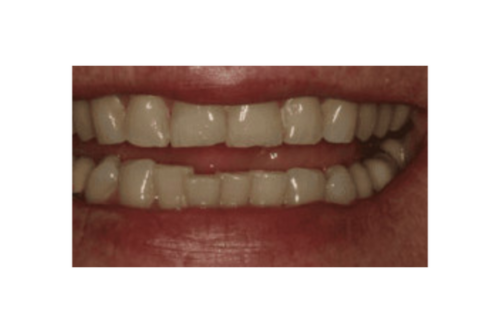before dentistry from Joseph P. Cavallo, DDS, MAGD