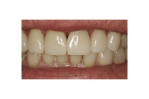 after dentistry from Joseph P. Cavallo, DDS, MAGD