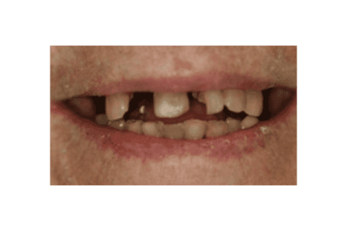 before dentistry from Joseph P. Cavallo, DDS, MAGD