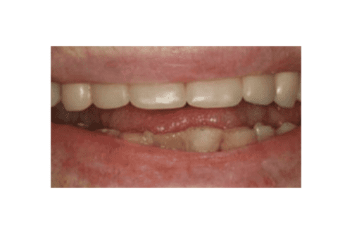 after dentistry from Joseph P. Cavallo, DDS, MAGD